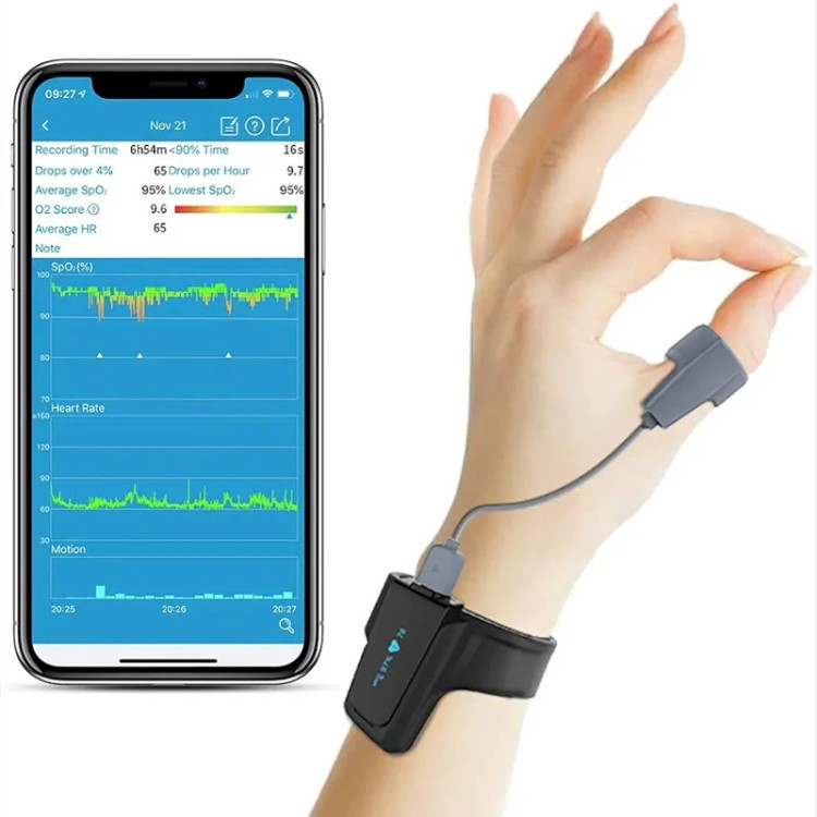 پالس اکسیمتر هوشمند برندCHECKME 02 PRO اکسیژن/اکسیژن خون /ضربان قلب